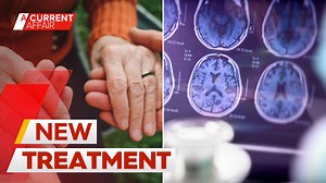 A first-of-its-kind treatment to slow the symptoms of early Alzheimer's has been approved for use in Australia. It won't stop the cruel disease, but it will slow the symptoms. It's something families and doctors are smiling about, however, it's not cheap. #9ACA | A Current Affair