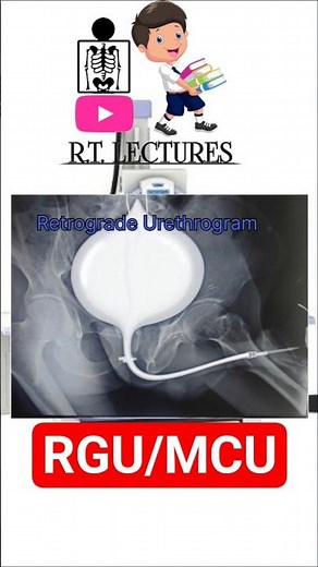 #RGU #MCU #Retrograde urography #Micturating Cystourethrogram