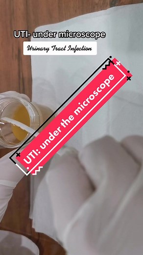 Diagnosing and Treating UTI: A Comprehensive Guide