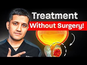 Enlarged Prostate Treatment Without Surgery | PAE Procedure Explained | Dr. Gaurav Gangwani