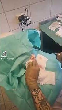 Tongue Split/ Zungenspaltung Bodymodification Bodymod