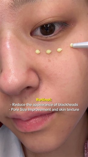Pores looking larger? Blackheads making an appearance?