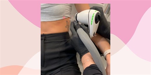 'I tried the world's most painless laser tattoo removal, here's what happened'