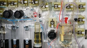 Clinical blood analysis and disease prevention. Automated Blood Laboratory. Advanced equipment automatic analysis of blood. automated chemistry analyzing process in medical laboratory. Human