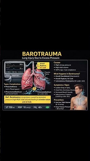 What is Barotrauma? Causes, Signs & Prevention | ICU Ventilator Basics