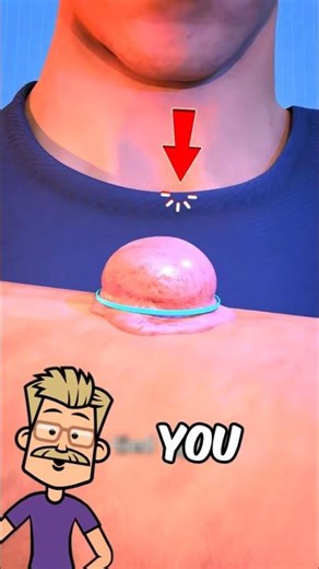 The Hand Lump You Should NEVER Pop 😱 #facts #survivaltips