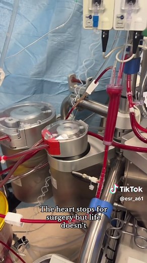On-Bypass🫀🫁 #heart #surgeon #perfusion #blood #tik_tok | heart
