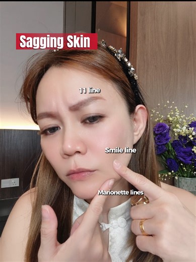 Comprehensive Lifting System for Youthful Skin