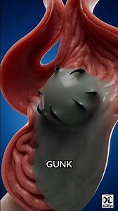 How Whale Vomit Becomes Gold 🤔