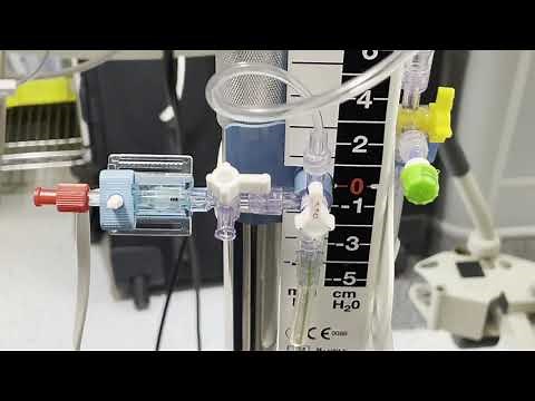 Intracranial Pressure Monitoring: INTEGRA-EVD Explained