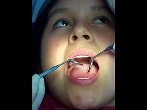 Medicina _ Pasos para un examen oral