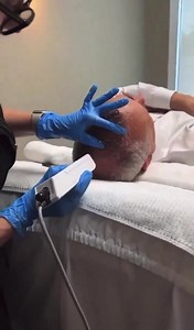 DERIVE HAIR RESTORATION is a very easy, quick, painless process! It’s done once a month, and is as easy as 1-2-3. No Needles! No Injections! No bloody PRP! We then give you a take-home serum which you apply twice a day, for 6 months… | Loraine V. Diego, MD, Inc.