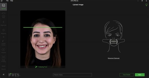 DTS offers the quickest and simplest workflow for Smile design simulations and previews, followed by 3D designs www.dentaltreatmentsimulation.com #DTSPro, #digitalsmiledesign #digitaldentistry | Neeraj S Rohida