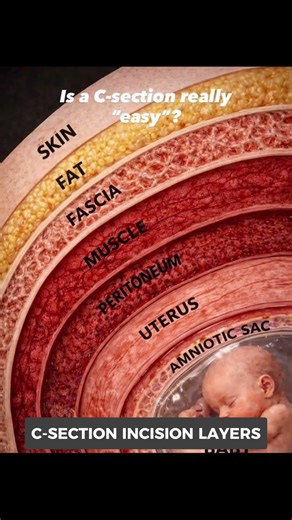 C Section Delivery Explained | 7 Layers Doctors Go Through During Cesarean Surgery