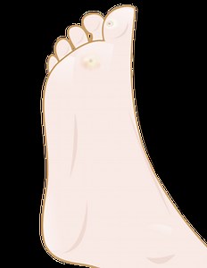 How to remove corns – 9 simple, but highly effective tips!