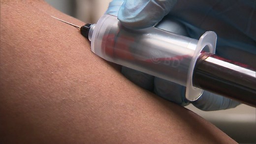 Las cinco cosas que la sangre puede decir sobre tu salud - CNN Video