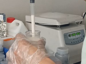 IF 18.5！通过电子补偿效应相互激活的2D Ti0.87O2/MXene单层作为锂氧电池高效阴极催化剂