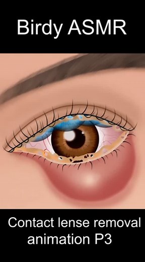 Birdy Finch ASMR on Instagram: "Contact lense removal p3 #asmr #animation #viral #trending #shorts 40 sec"