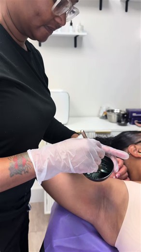 Discoloration has been something so many women quietly struggle with but you don’t have to keep hiding it. Intimate bleaching may just be the solution for you. It’s a quick, effective service that yields results in just a few sessions. If you’ve been thinking about starting your intimate brightening journey, this is your sign. 💕 Click the link in my bio and schedule now