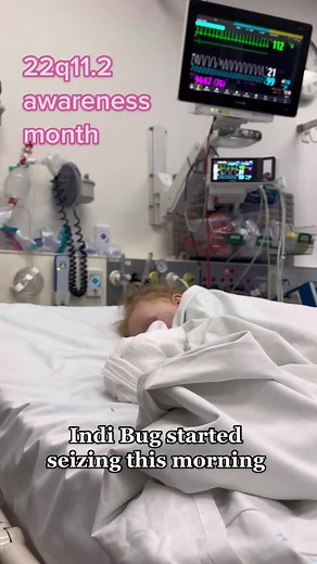 Understanding 22q Deletion Syndrome: Unveiling the Rare Disorder