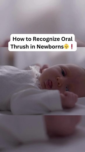Recognizing Oral Thrush Symptoms in Newborns