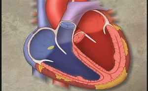 Understanding Atrial Fibrillation