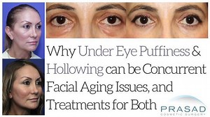 Cost Difference Between Eyelid Rejuvenation and Eyelid Surgery