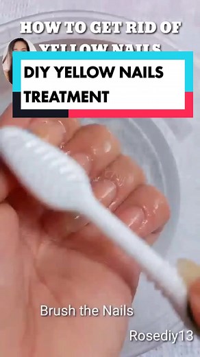 DIY Yellow Nail Solution