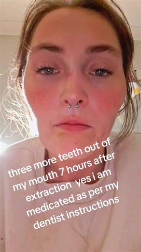 Understanding Dentures After Tooth Extractions