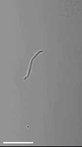 🦠🦷😁Ever wonder what’s in your plaque? These super-fast-dividing bacteria, shown multiplying over 23.5 hours by NIH-supported research, are one species that cultivates cavity-causing plaque. Brushing, flossing, and dentist visits can keep this sticky substance in check. Credit: Scott Chimileski, Gary G. Borisy, Floyd E. Dewhirst, Jessica L Mark Welch | National Institutes of Health (NIH)