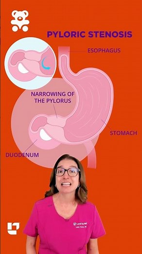 Pyloric Stenosis Explained in 60 Seconds | Key NCLEX Signs: Pediatrics SHORT | ‪@LevelUpRN‬