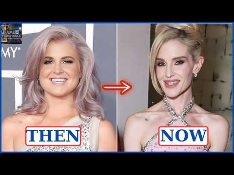 10 Celebrity Ozempic Transformations Gone Wrong | Then & Now 2026