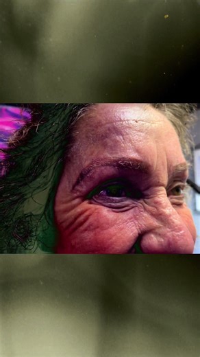 Transforming Sparse Brows with Tattooing Techniques