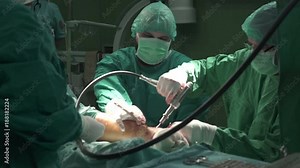Orthopedic senior surgeons team using surgical tools to drilling and screwing metal brace on bone of patient ankle, surgery in operating room, medical workers wearing mask, gloves and gowns,tracking.