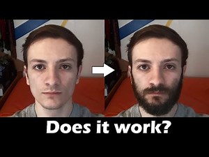 Derma Rolling for Beard Growth| Does It Work?!