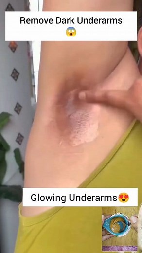 320K views · 1.6K reactions | Rid Dark & Smelly Armpit | Underarms Cleaning Tips & Trick . . . #darkarmpit #smellyarmpit #armpit #underarmscleaningtips #skincare #treandingreels #fypreels #reelsvideo #reelsfbシ #fypreels #fbreelsvideo #explorepage | Natural Beauty Remedy | Facebook