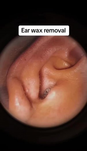 Dr Removal on TikTok