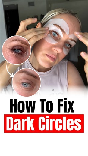 HOW TO GET RID OF DARK CIRCLES AND PUFFY EYES