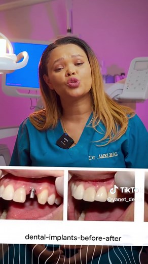 በተለያዬ አዉሮፓ ሀገራት በቂ እዉቀት!!!! #health #fyp #habshatiktok #ቫይራል #ethiohealth #lamnting porcelin veneer#implante