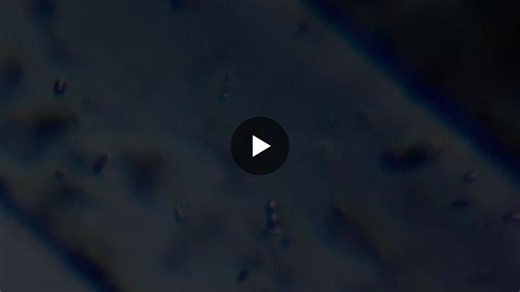 Introducing Bugcount Analyzer for Microbial Testing | Luminultra posted on the topic | LinkedIn