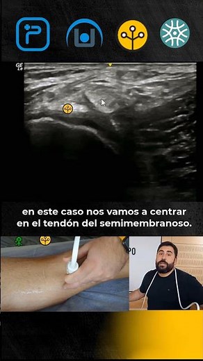 Musculo semimembranoso con Edgar Aljaro