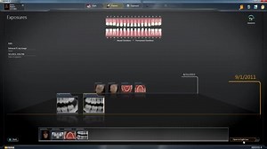 SIDEXIS 4. The new gold standard With #SIDEXIS 4, you can apply the advantages of integrated dental workflows for optimal results. The X-ray software saves time, is safe, and improves your results. At the same time, its modern user interface makes it incredibly easy to operate. Learn more: http://www.sirona.com/en/products/imaging-systems/sidexis-4/ | Dentsply Sirona
