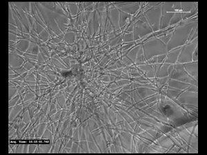 Ralstonia solanacearum lipopeptide induces chlamydospore development in fungi and facilitates