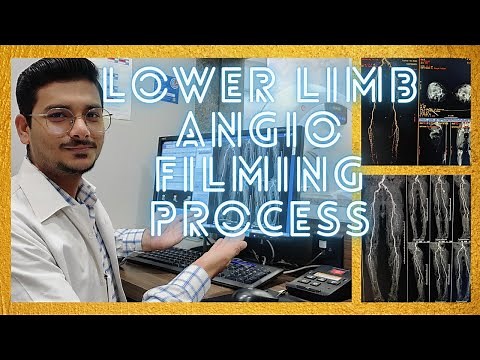 CT SCAN LOWER LIMB ANGIOGRAPHY FILMING PROCESS/TECHNIQUE | #angiography #radiologytechnologist