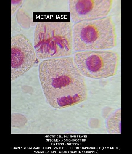 QUICK GUIDE TO ONION ROOT TIP CELL DIVISION STAGES (PROPHASE, METAPHASE, ANAPHASE & TELOPHASE)