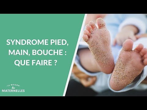 Syndrome pied, main, bouche : que faire ? - La Maison des maternelles #LMDM