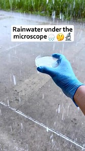 1.1M views · 4.7K reactions | Under Microscope 400X  . . . . . #microscope #undermicroscope #viralreels #trandingreels #instagram #microscope_world #amazing | Microscope Under | Facebook