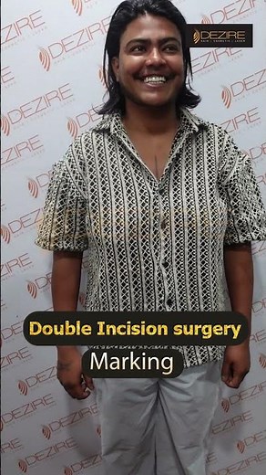 Double Incision Top Surgery Planning | Female to male surgery