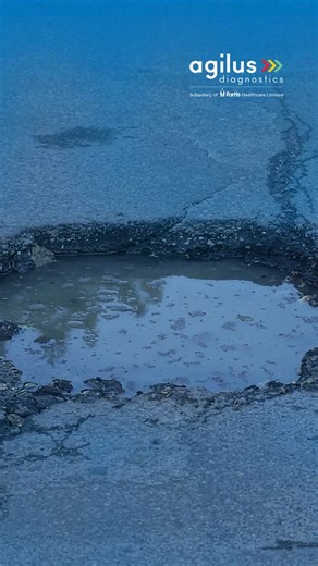 With every rain shower, stagnant puddles become breeding grounds for mosquitoes – and with them, the risk of fever rises fast. Don’t wait for symptoms to worsen. Get tested and know the cause of your fever with Agilus Diagnostics’ Complete Fever Panel. Call to book: 91115-91115. #KhudKoTestKarteyRaho #AgilusDiagnostics #KeepTestingYourself | Agilus Diagnostics