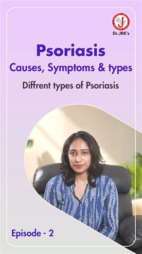 In Episode 2 of our Psoriasis Awareness Series, we explore three major types of psoriasis 👇 ✨ Plaque Psoriasis – red, raised patches with silvery scales ✨ Guttate Psoriasis – drop-shaped spots after infections ✨ Inverse Psoriasis – shiny red patches in skin folds Each type looks different — but awareness helps manage them better. 🎧 Next episode: More psoriasis types explained! Stay tuned. . . [psoriasis types, plaque psoriasis, guttate psoriasis, inverse psoriasis, psoriasis symptoms, psoriasi